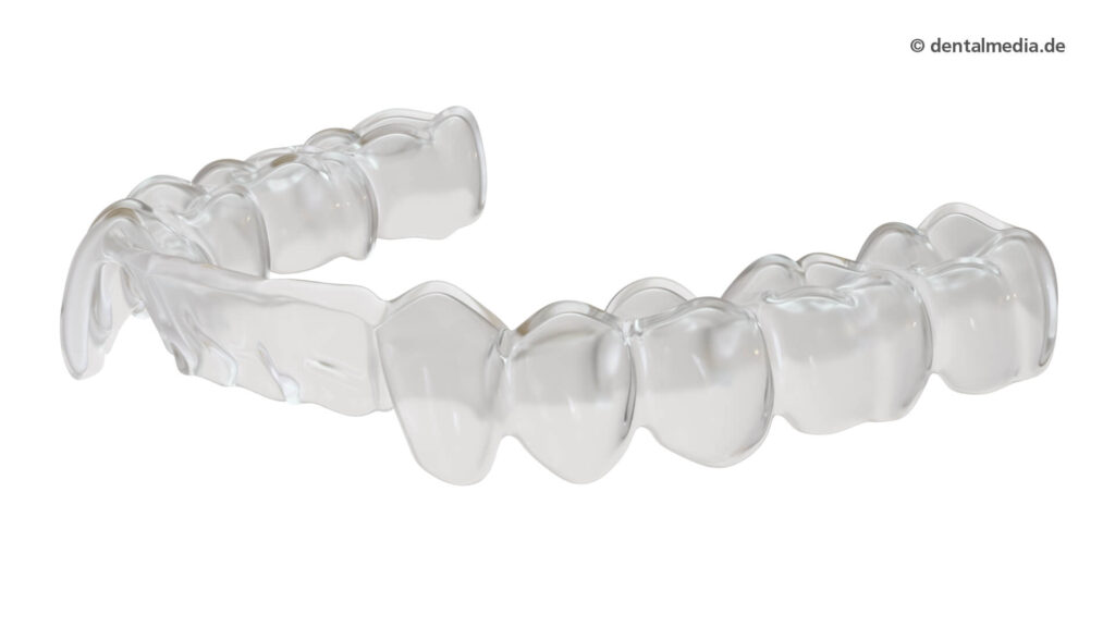 Sportperformance-Zahnschiene